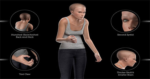 Sự Biến Đổi Cơ Thể Con Người Đến Năm 2100: Nỗi Lo Từ Công Nghệ