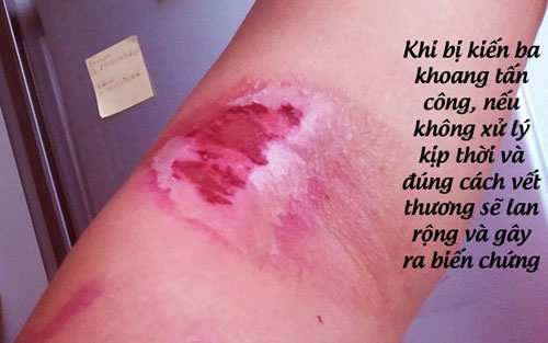 Hậu quả nghiêm trọng nếu không xử lý kịp thời