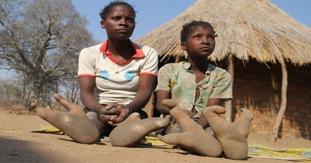 Khám Phá Bộ Lạc Vadoma: Người Đà Điểu Kỳ Bí Tại Châu Phi