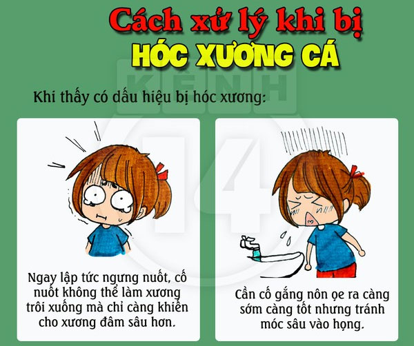 Hướng Dẫn Xử Lý Khéo Léo Khi Bị Hóc Xương Cá