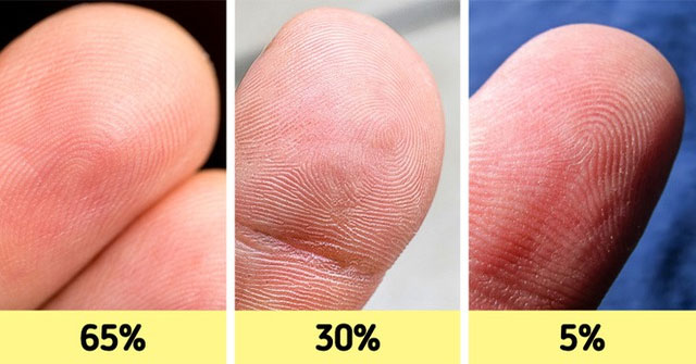 12 Đặc Điểm Cơ Thể Độc Đáo Chỉ Một Số Ít Người Sở Hữu